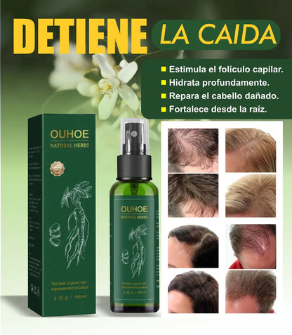 OUHOE – Crecimiento Capilar Rápido y Saludable ✨🌿